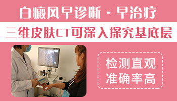 手指头皮肤上长白斑怎么办